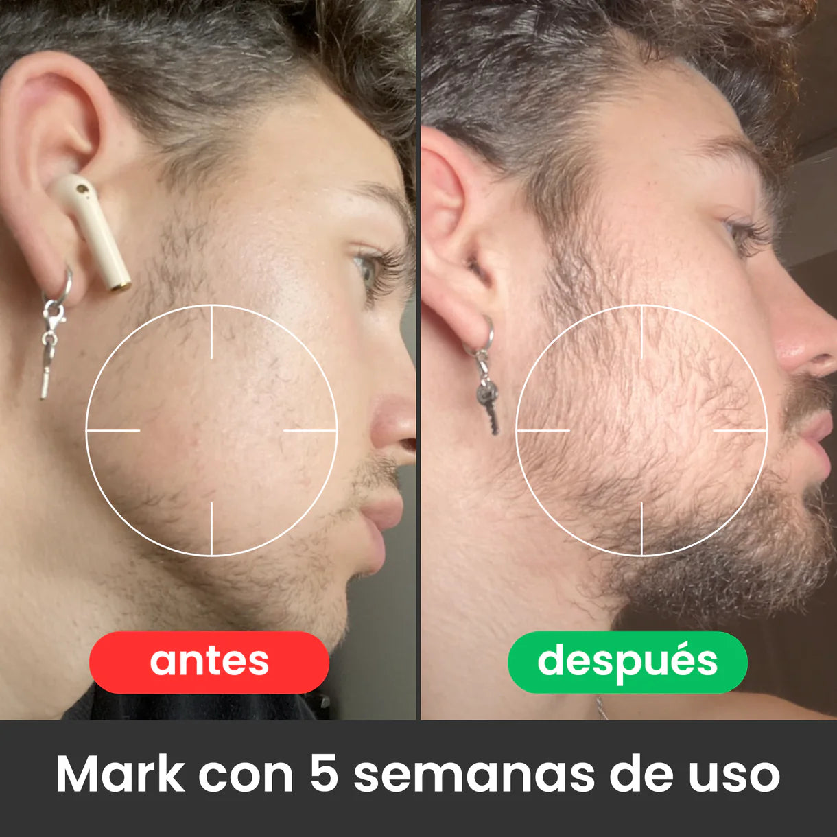 Bálsamo para Crecimiento de Barba Ultra Potente con Minoxidil 20% | 100mL